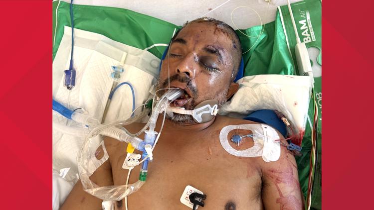University Hospital asks for help identifying unconscious patient hit by truck Saturday evening — KENS 5 (San Antonio), Los Gatos Health news
