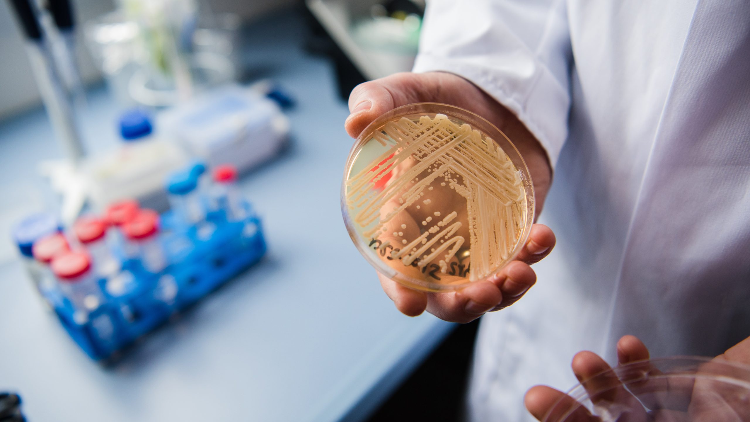 New study reveals why dangerous fungus is so difficult to treat — KTVU FOX 2 Bay Area, Los Gatos Community news